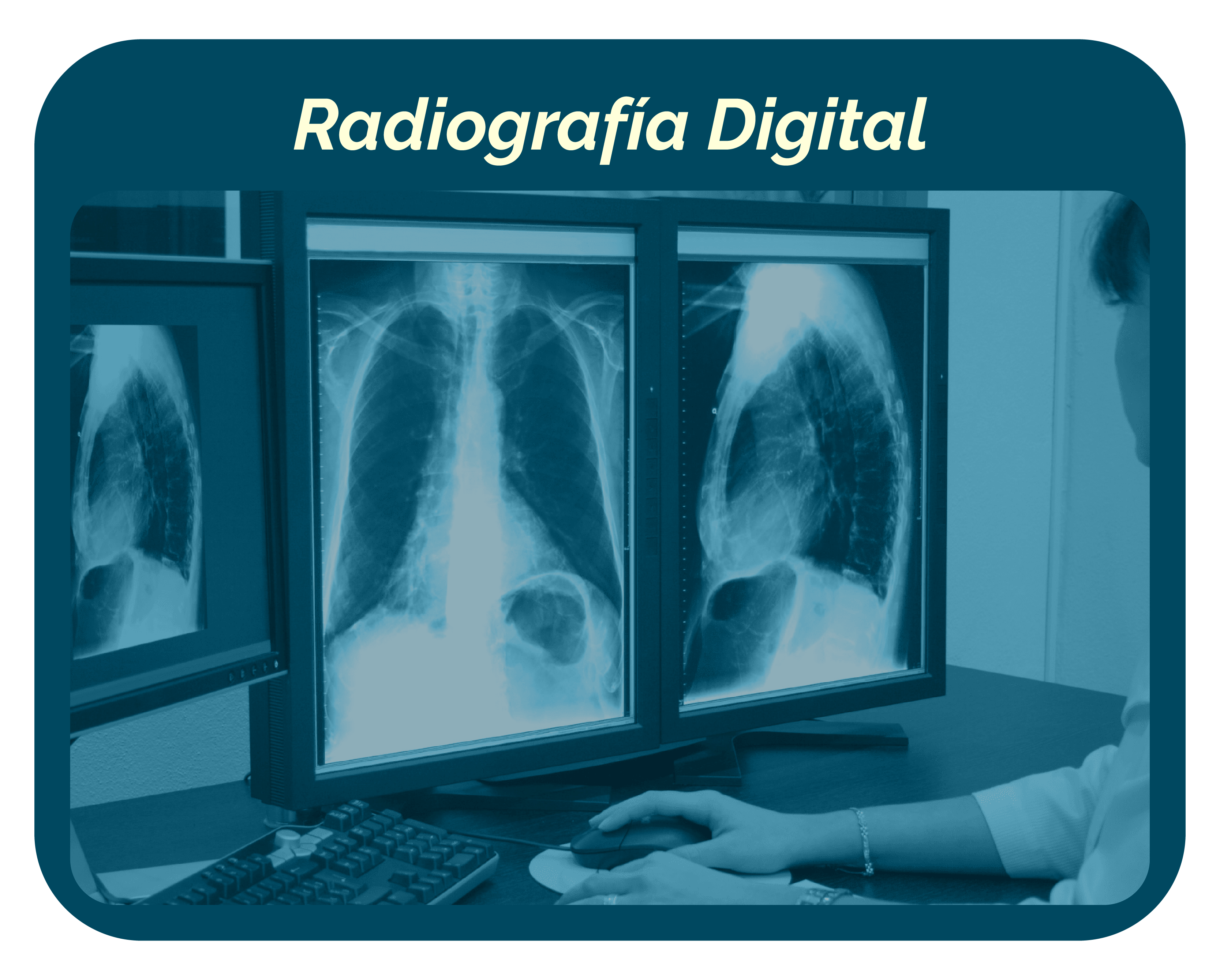 Radiografía Digital